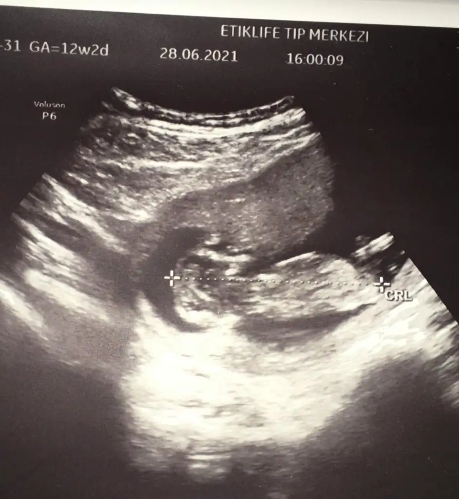 WhatsApp Image 2021-06-28 at 20.26.41.webp