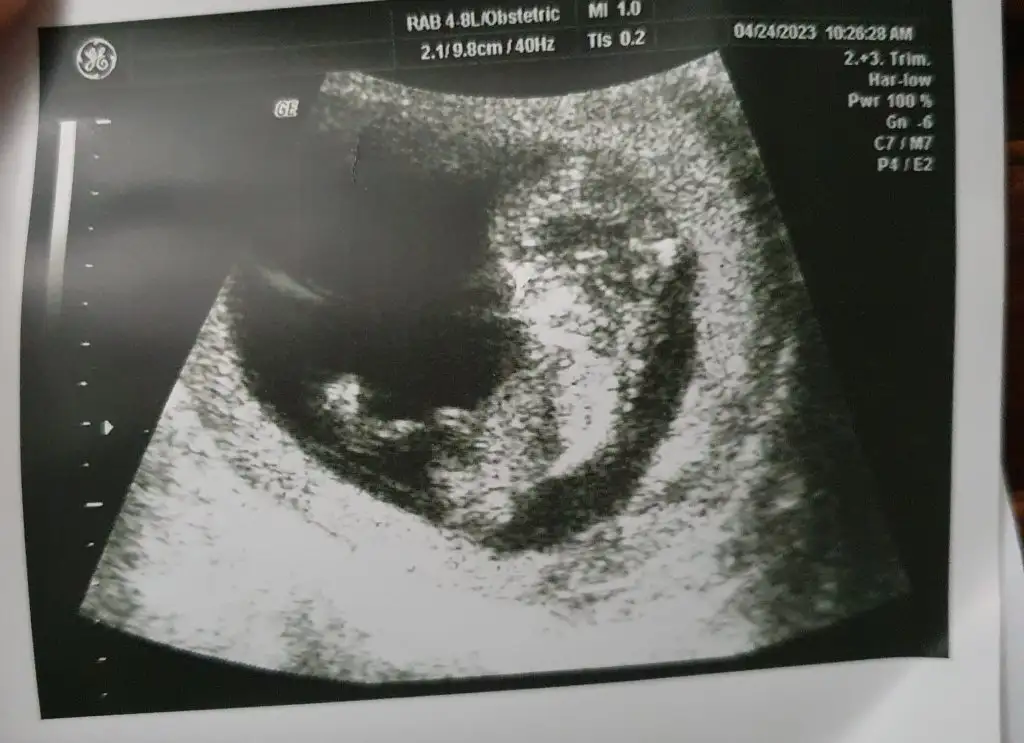 WhatsApp Image 2023-05-02 at 14.27.55.webp