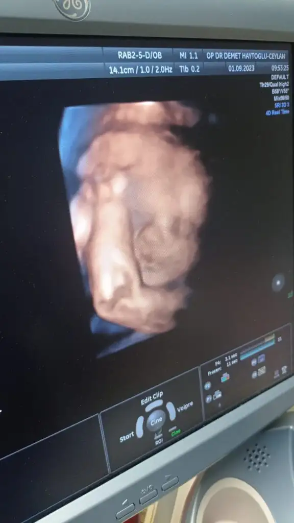 WhatsApp Image 2023-09-01 at 11.11.16.webp