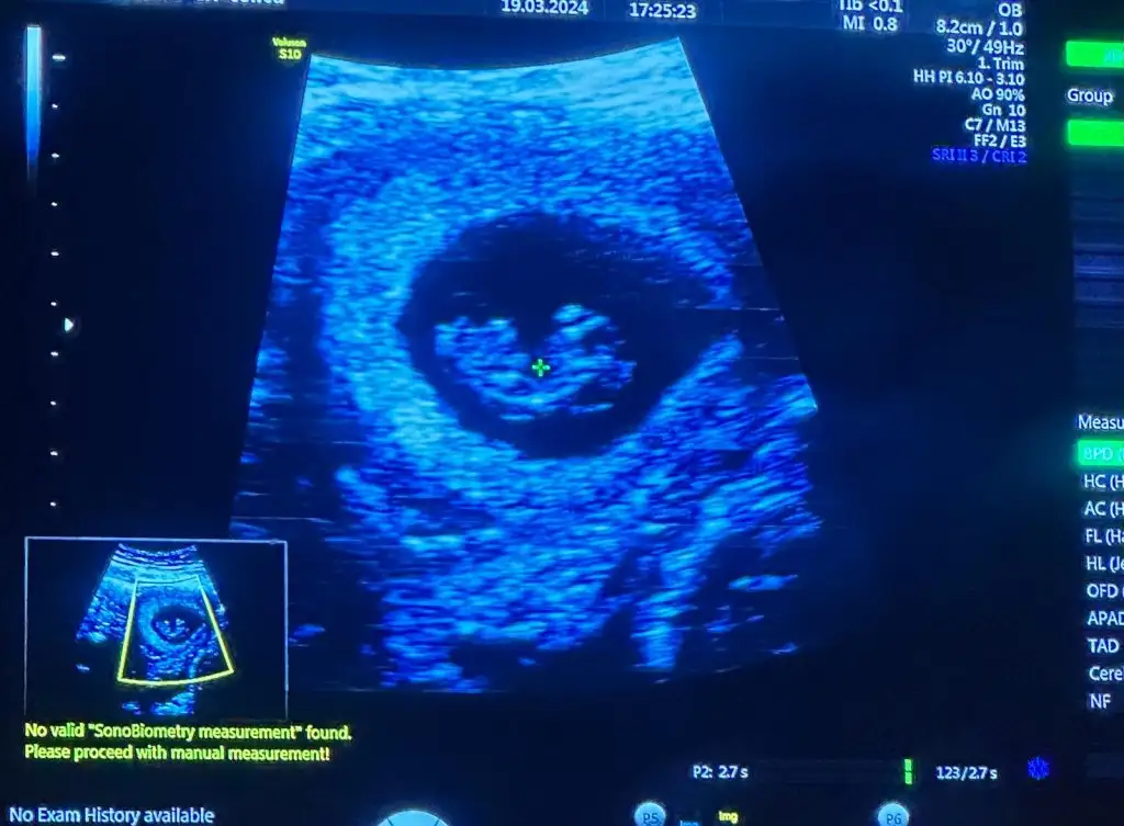 WhatsApp Image 2024-03-28 at 9.08.40 AM.webp