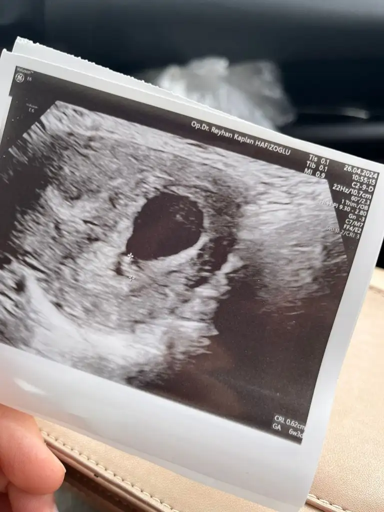 WhatsApp Image 2024-04-26 at 12.00.06.webp