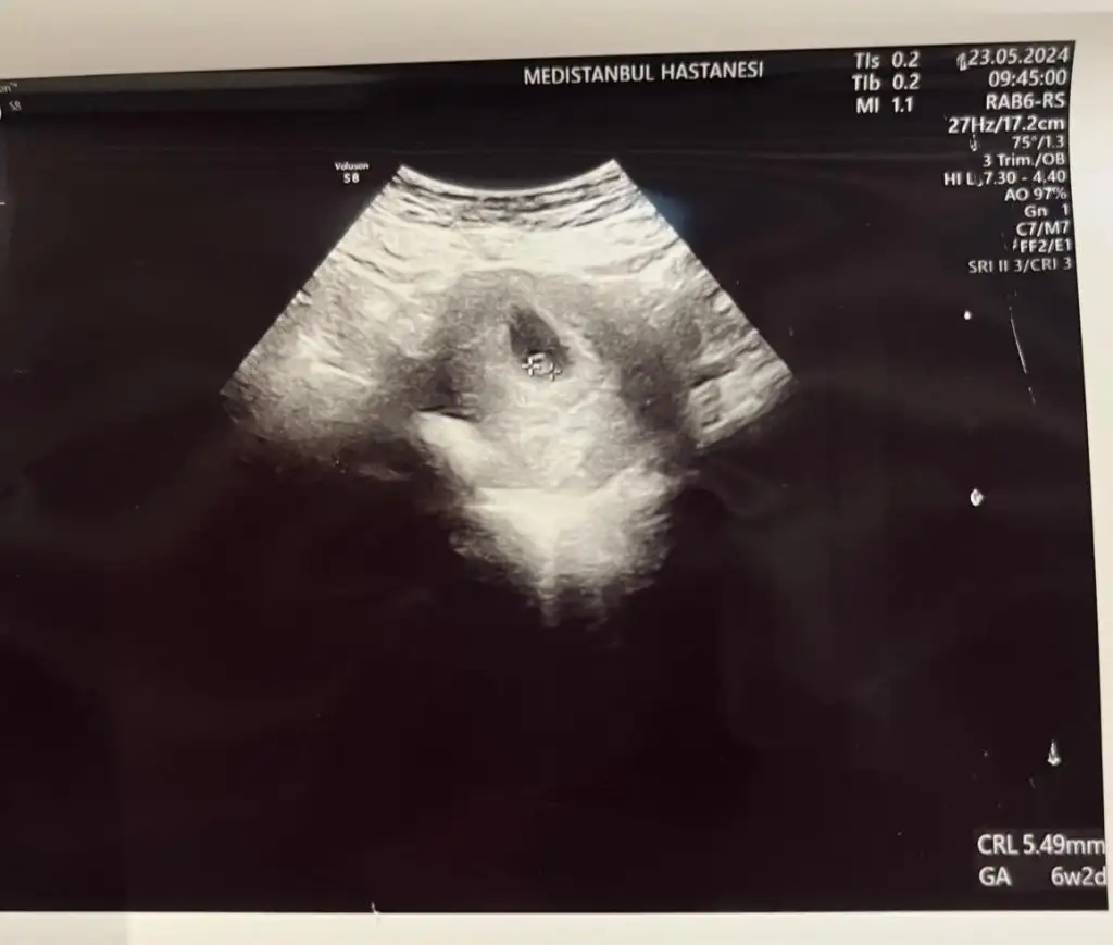 WhatsApp Image 2024-05-23 at 12.18.07.webp