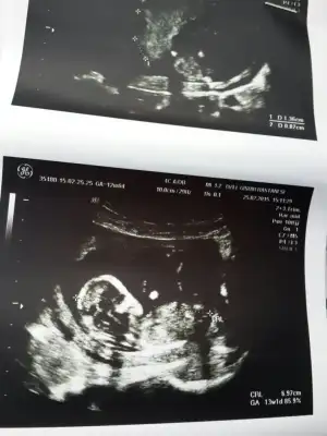 2015-02-25 15.38.41.webp