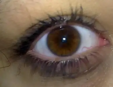 $040720111605.webp