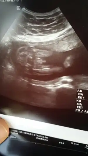 image.webp image.webp