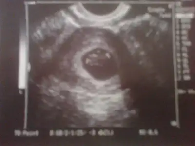 $02082011140.webp