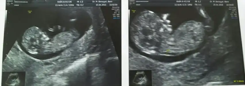 2015-04-15 15.36.19.webp