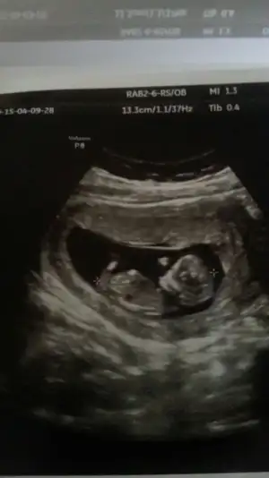 Cücük 13. haftada.webp