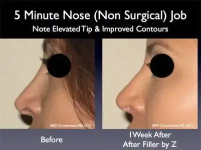 nose.webp