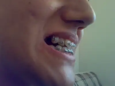 $030820111678.webp