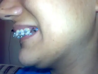 $030820111675.webp