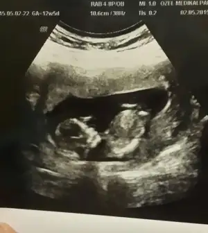 2015-05-02 12.46.55.webp