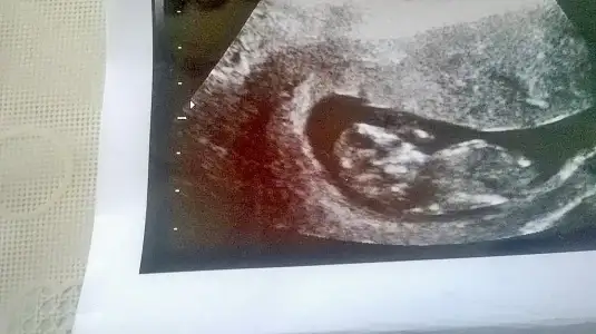 C__Data_Users_DefApps_AppData_INTERNETEXPLORER_Temp_Saved Images_WP_20150430_002.webp