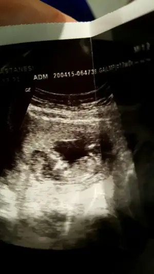 2015-04-20 17.41.44.webp