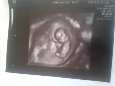 2015-05-06 11.11.39.webp