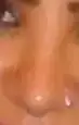 $ameliyattan sonra3.webp