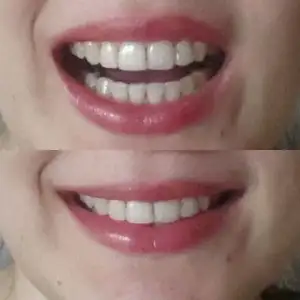 2015-07-29 12.36.19.webp