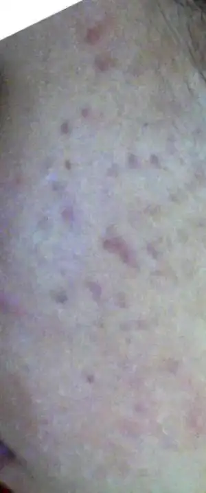 $15.08.2011.webp