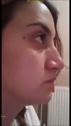 20150811_170131_20150811_171012_20150906_214212.webp 20150811_170131_20150811_171012_20150906_214212.webp