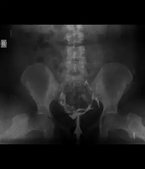 FERİDE EBRU YILMAZ (1).webp