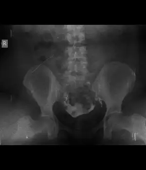 FERİDE EBRU YILMAZ (2).webp