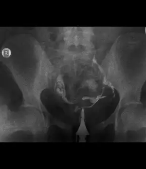 FERİDE EBRU YILMAZ.webp