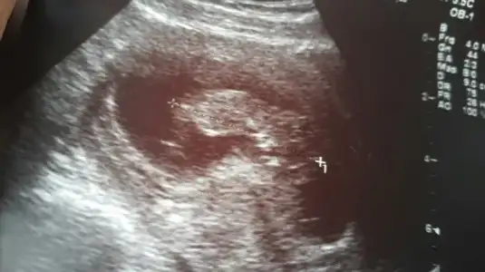 2015-11-17 12.53.54.webp