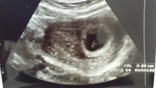 2015-12-01 10.49.37.webp