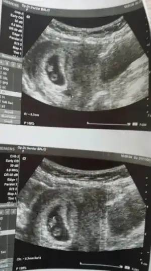 2015-12-01 12.56.28.webp