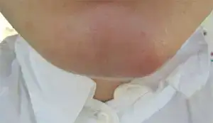 $Ã§eneÃ¶n1.webp