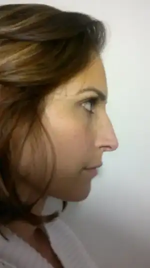 Nase3.webp