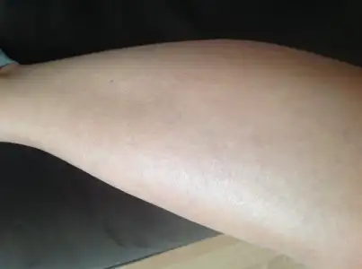 image.webp