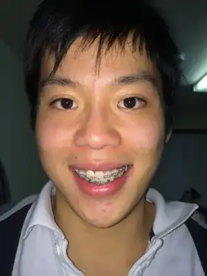 image.webp