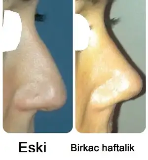 eski.webp