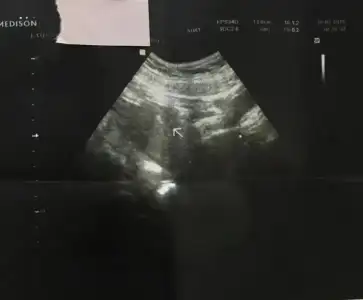 12765597_10153927915328609_529986149_o (2).webp