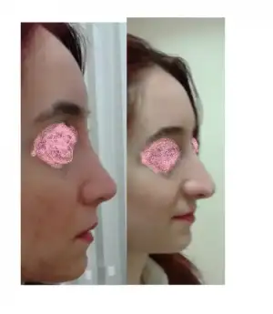 6 aylık muurun.webp