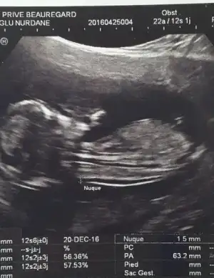 2016-06-06 16.08.57.webp