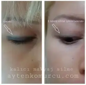 kalıcı eyeliner silme.webp