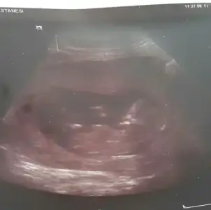 2016-08-03 13.51.33.webp