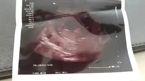 2016-08-05 12.10.16.webp