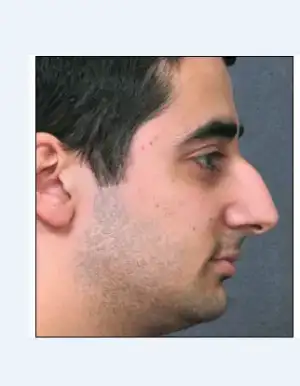 Ekran Alıntısı.webp