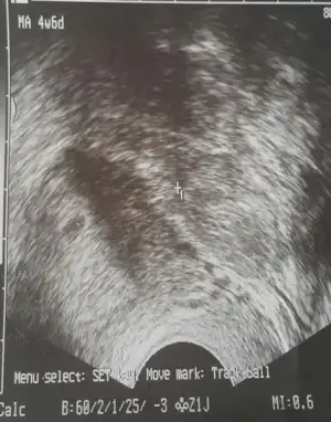 2016-08-20 14.37.49.webp