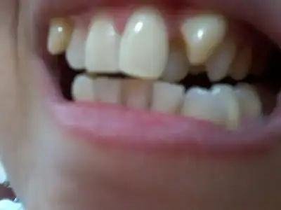 Fotoğraf0367.webp