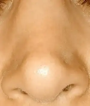 15175390_953571128080637_464829043_n.webp