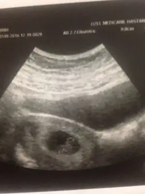 WhatsApp Image 2016-12-19 at 20.53.57.webp