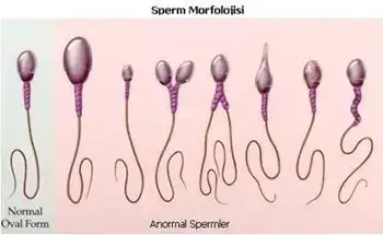 sperm-morfoloji.webp