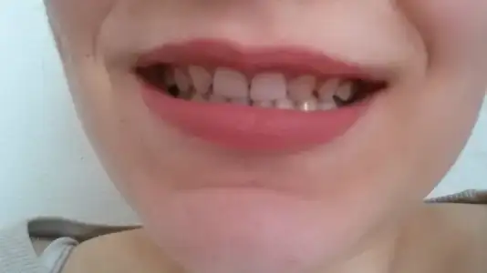20170128_160812.webp