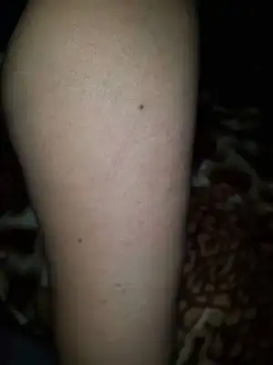 received_10212490468876285.webp
