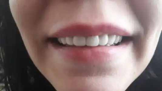 IMG-20170313-WA0000.webp