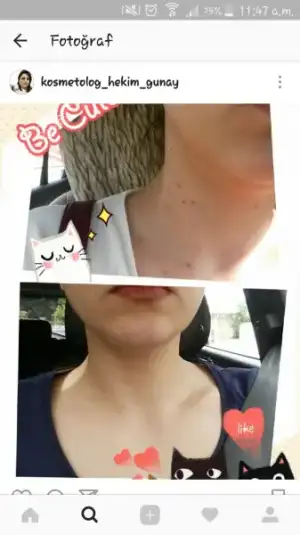 Screenshot_2017-03-25-11-47-59.webp